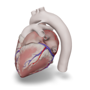 Atrioventricular Septal Defect TM SYS 3D